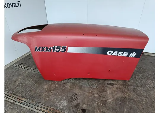 Case IH MXM 155 konepeitto / Traktorin konepelti
